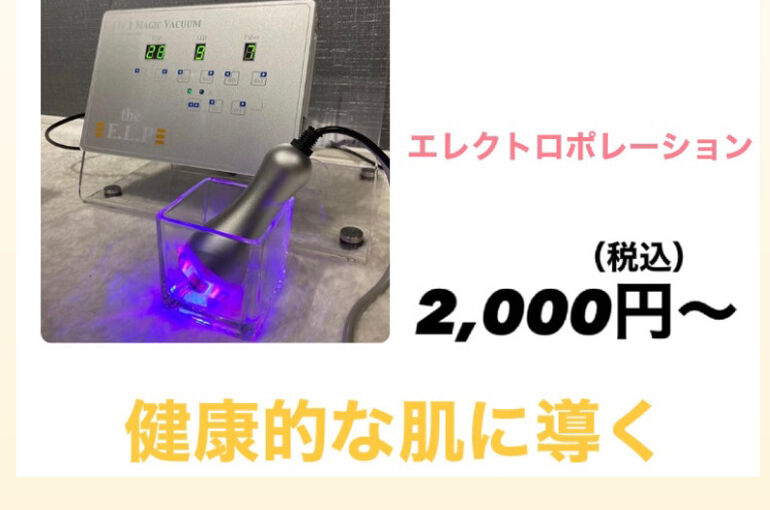 エレクトロポレーション