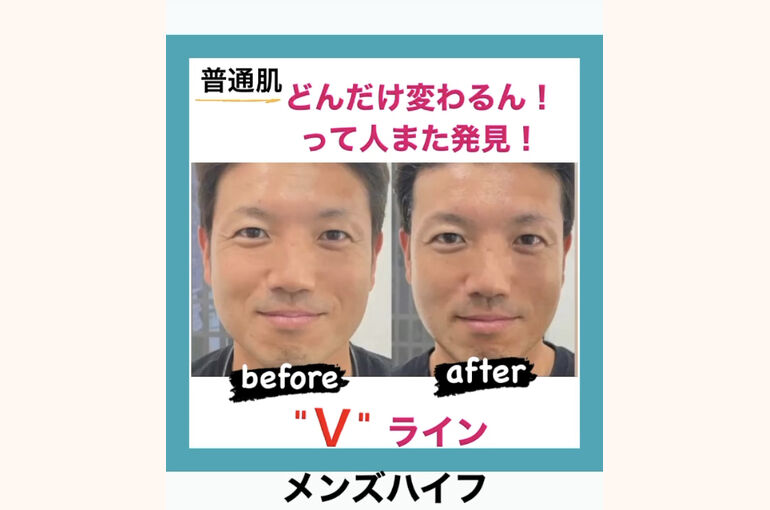 小顔になって肌艶アップ！
