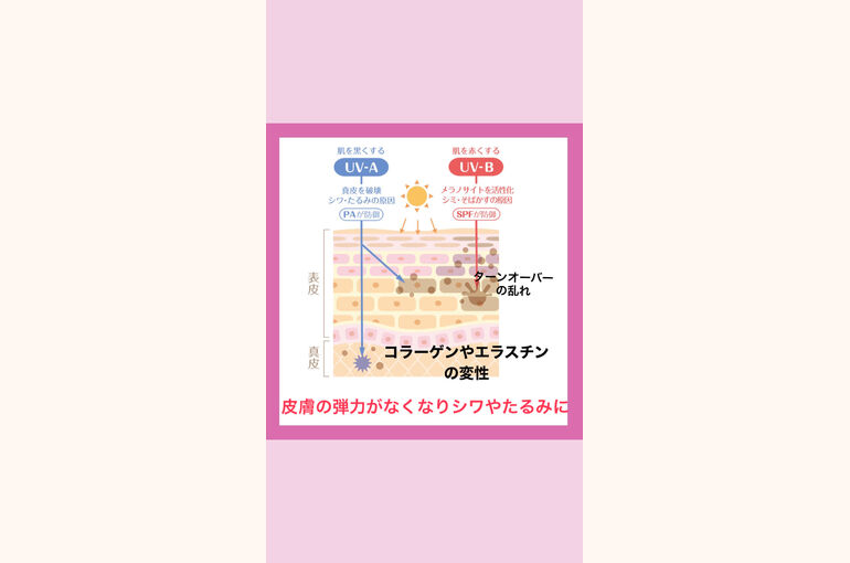 エレクトロポレーション　夏のダメージ