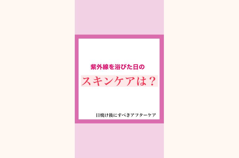 日焼け止め　紫外線　アフターケア