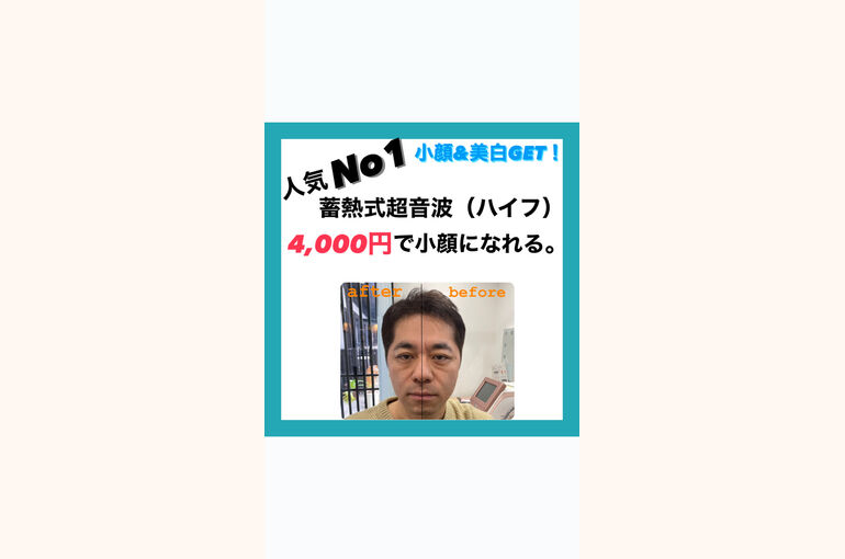 No 1 蓄熱式超音波　小顔　美白　リフトアップ