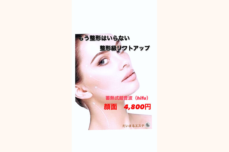 整形級リフトアップ
