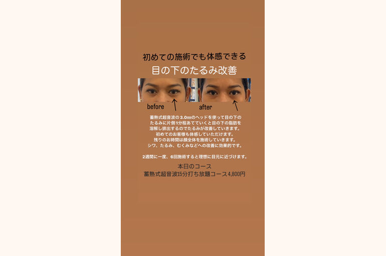 5F055D80-1620-42E6-AE42-94C6C442382F